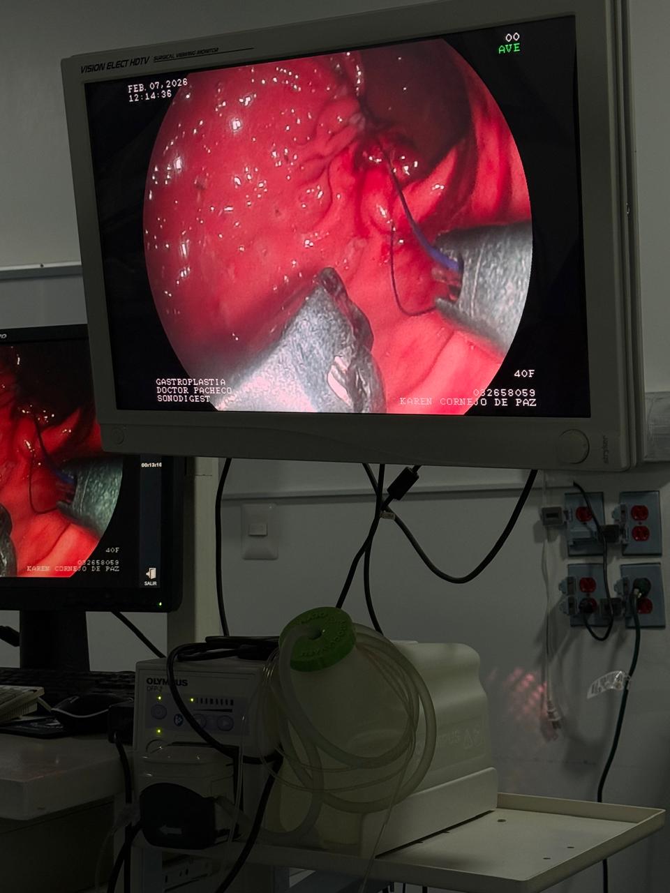 Monitor Quirófano